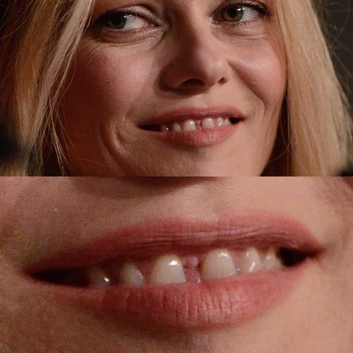 Δόντια Vanessa Paradis
