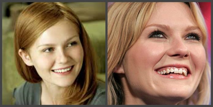 Δόντια Kirsten Dunst