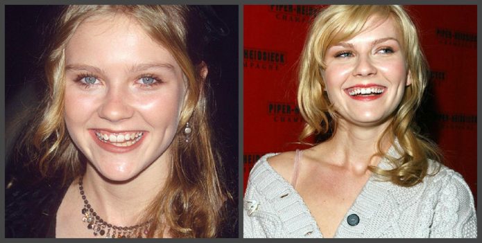 Δόντια Kirsten Dunst