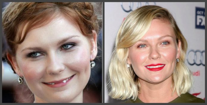 Δόντια Kirsten Dunst