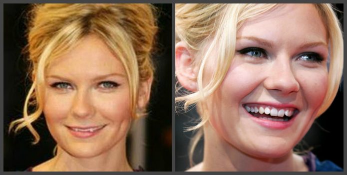 Δόντια Kirsten Dunst