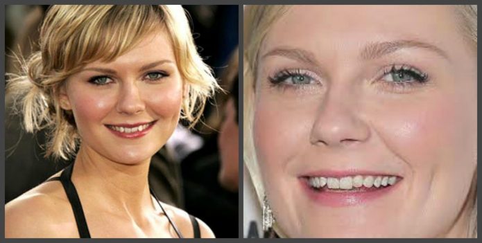 Δόντια Kirsten Dunst