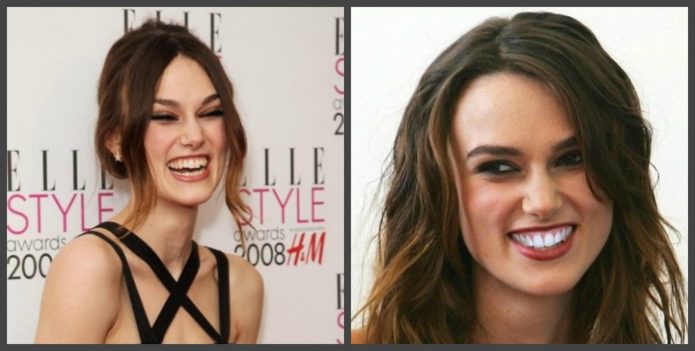 Keire Knightley τα δόντια πριν και το πεδίο