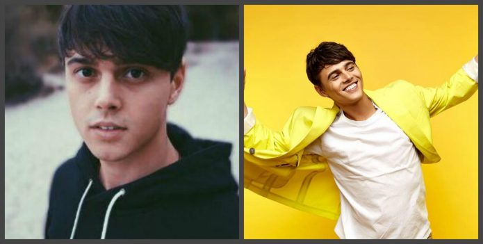Alekseev δόντια πριν και μετά