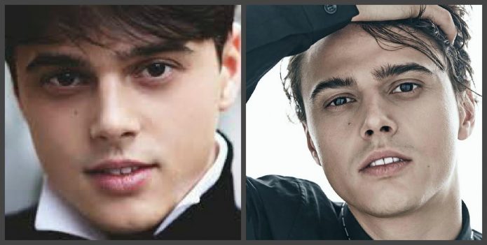 Alekseev δόντια πριν και μετά