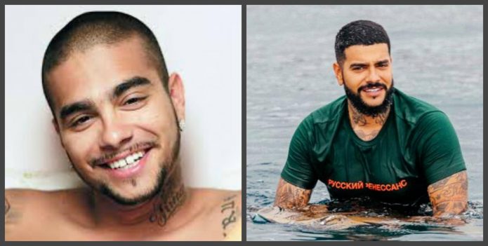 Τα δόντια του Timati πριν και μετά