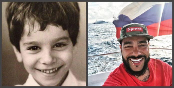 Τα δόντια του Timati πριν και μετά