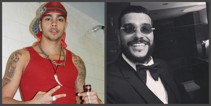 Τα δόντια του Timati πριν και μετά