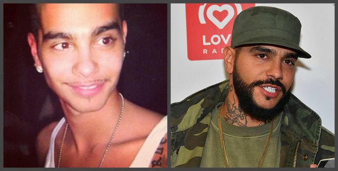 Τα δόντια του Timati πριν και μετά