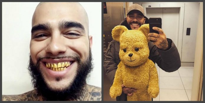 Τα δόντια του Timati πριν και μετά