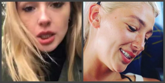 Nastya Ivleev δόντια πριν και μετά