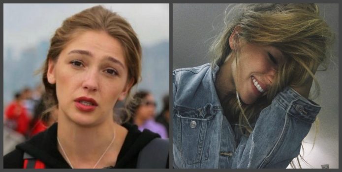 Nastya Ivleev δόντια πριν και μετά