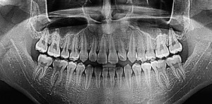 Πώς εκτελείται το orthopantomogram;