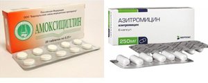 Θεραπεία οδοντικής ροής
