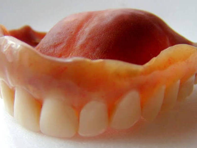 Τεχνικές κατασκευής οδοντοστοιχιών σιλικόνης