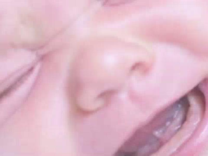 Έντονη κοπή δοντιών Cry και ανησυχείτε τα παιδιά