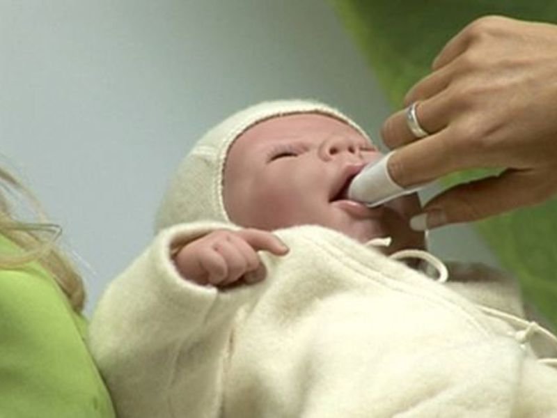 Λευκή επίστρωση στη γλώσσα Πώς να βοηθήσετε με την στοματίτιδα