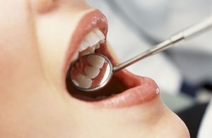 Οι πιο συνηθισμένες αιτίες ενός αποστήματος στα ούλα