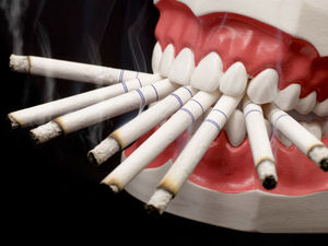 Τι να μην κάνετε μετά την εξόρυξη δοντιών