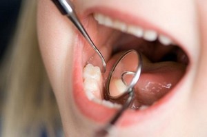 Λόγοι για τη χρήση της έκπλυσης Listerine
